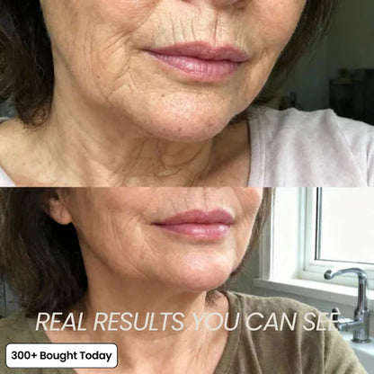 🔥LAST DAY 50% OFF!! Tombrace Korean Calcium Dark Spot Eye Cream