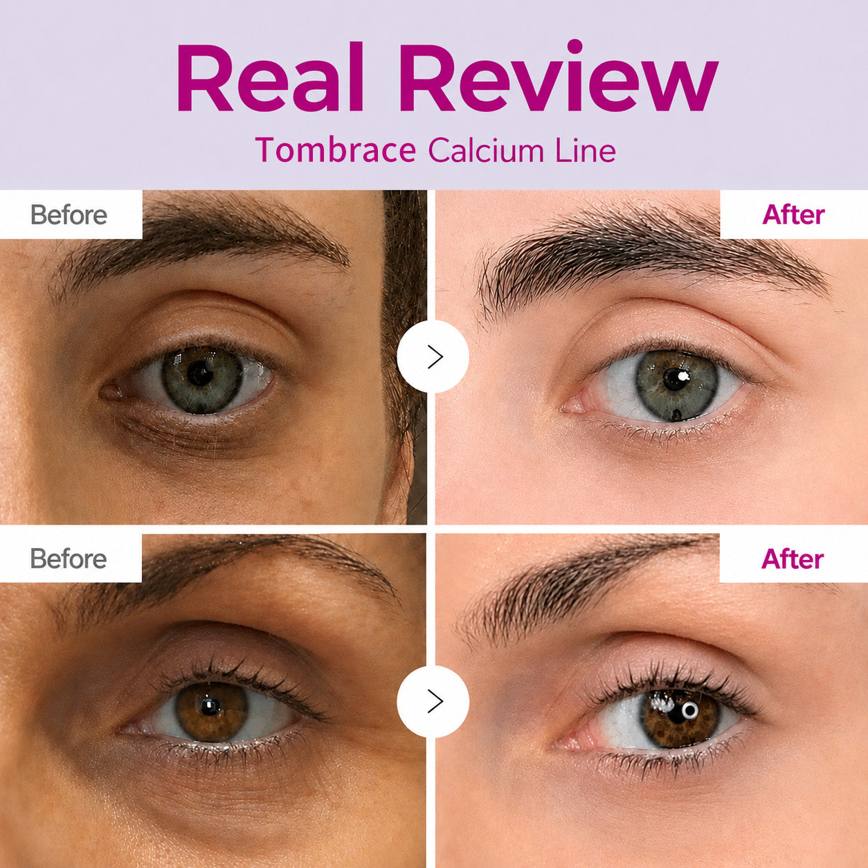 🔥LAST DAY 50% OFF!! Tombrace Korean Calcium Dark Spot Eye Cream