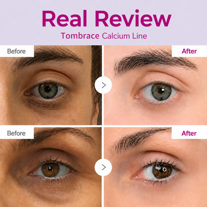 🔥LAST DAY 50% OFF!! Tombrace Korean Calcium Dark Spot Eye Cream