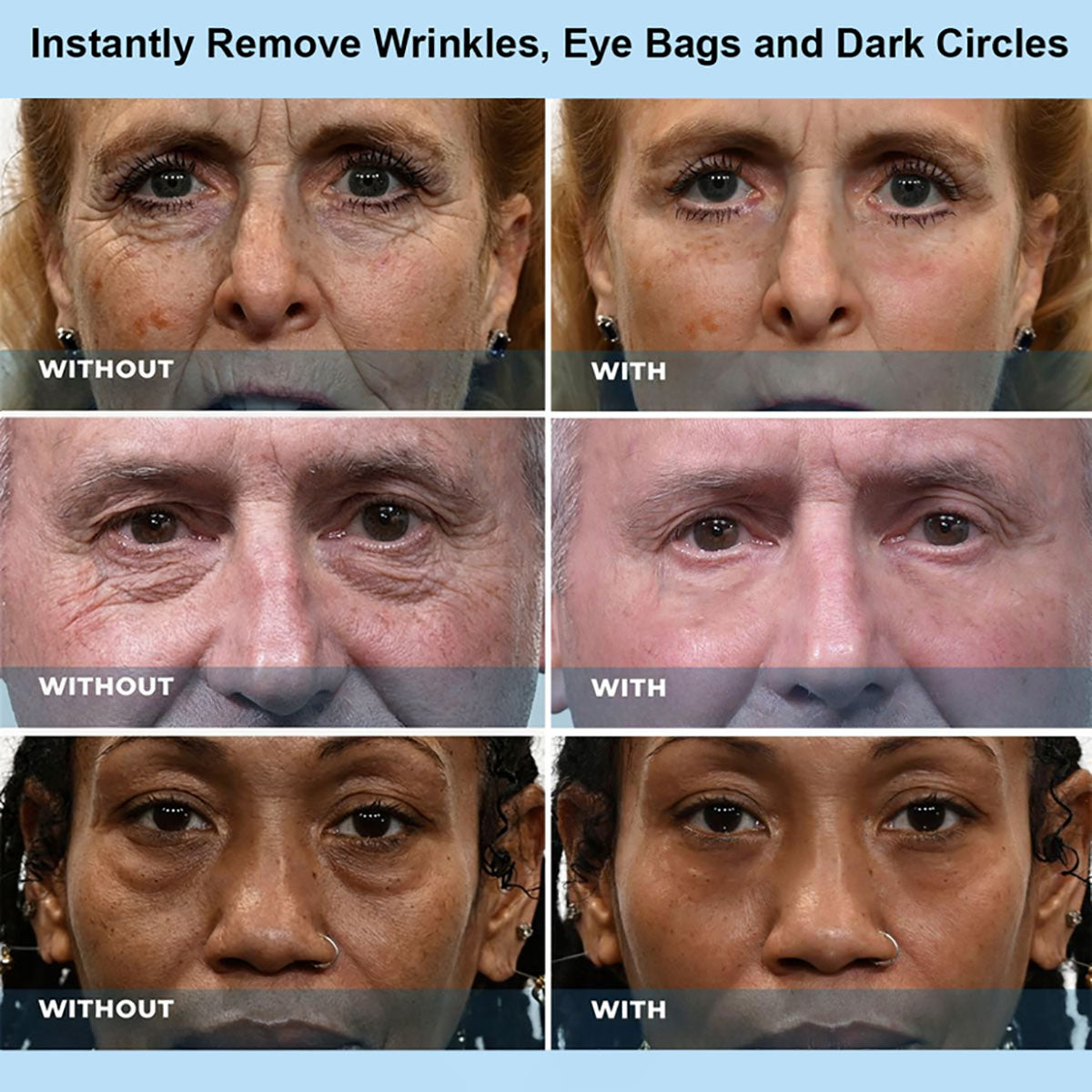 Tombrace™ Instant Face Temporary Tightener – Instant visible results in 60 seconds