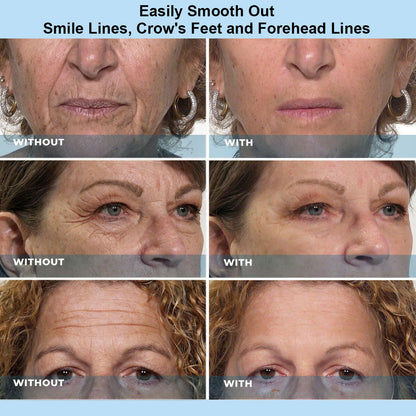 Tombrace™ Instant Face Temporary Tightener – Instant visible results in 60 seconds