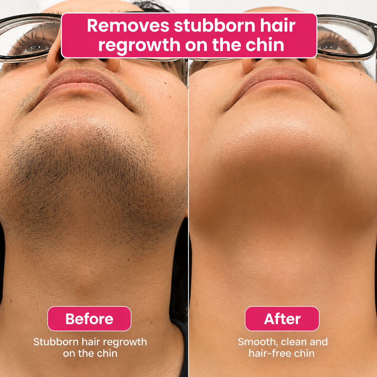 🔥 LAST DAY 60% OFF | Tombrace Hair Reduction Oil – Smooth, Softer Skin (60ml)