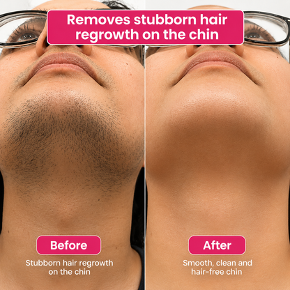 🔥 LAST DAY 60% OFF | Tombrace Hair Reduction Oil – Smooth, Softer Skin (60ml)