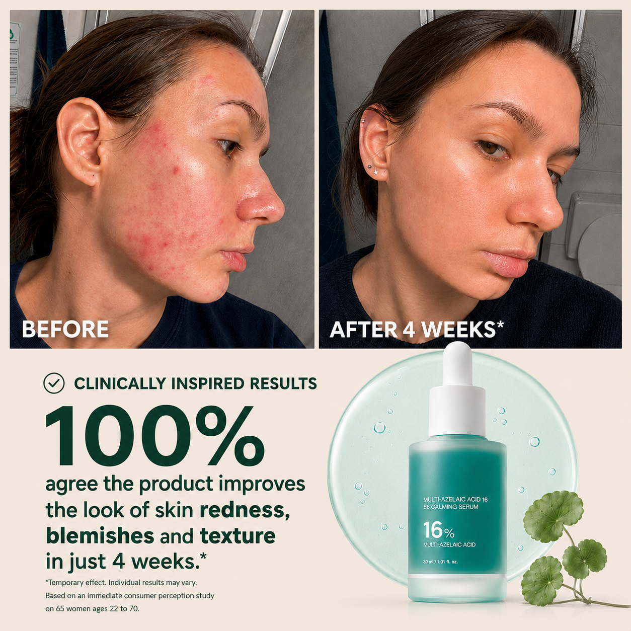 Tombrace Anchoic Acid Soothing Serum
