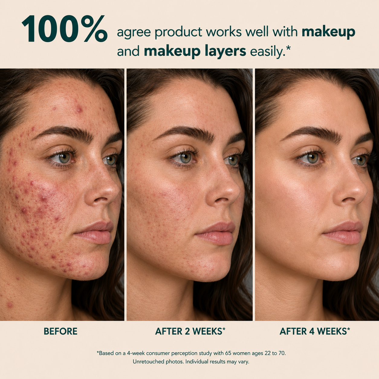 Tombrace Anchoic Acid Soothing Serum