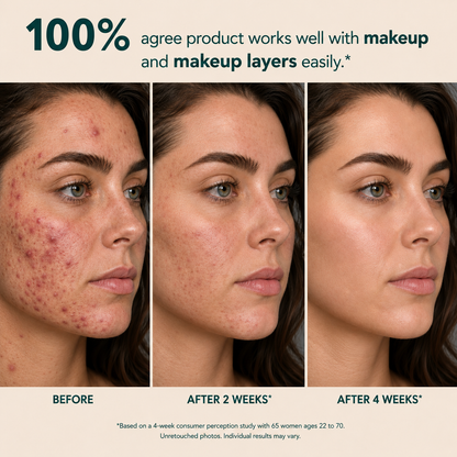 Tombrace Anchoic Acid Soothing Serum