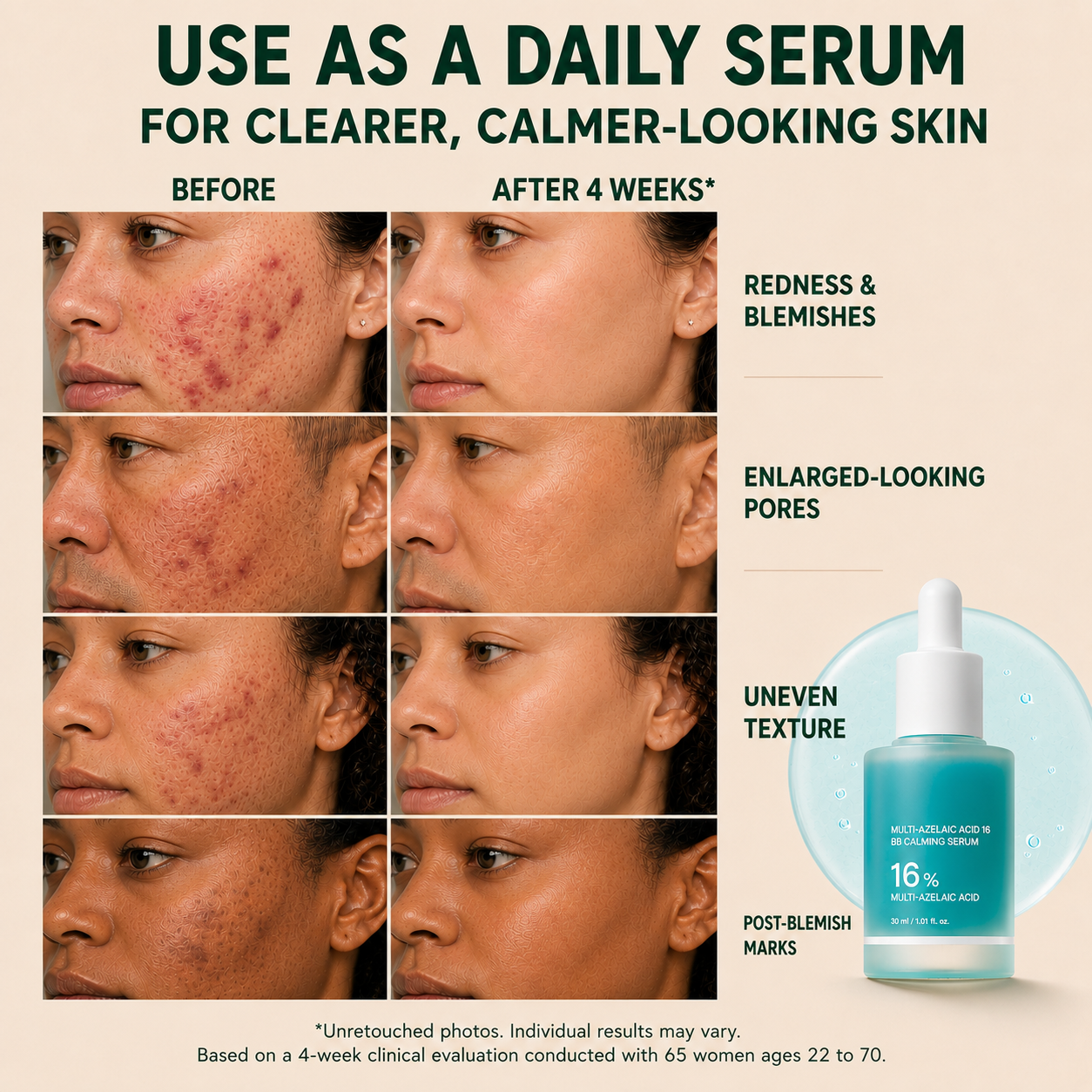 Tombrace Anchoic Acid Soothing Serum