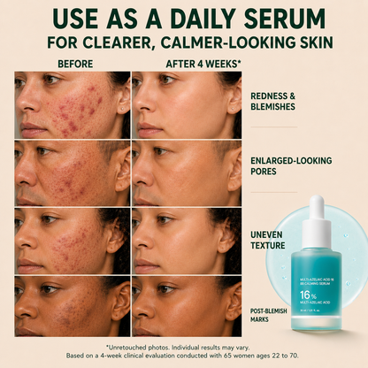 Tombrace Anchoic Acid Soothing Serum