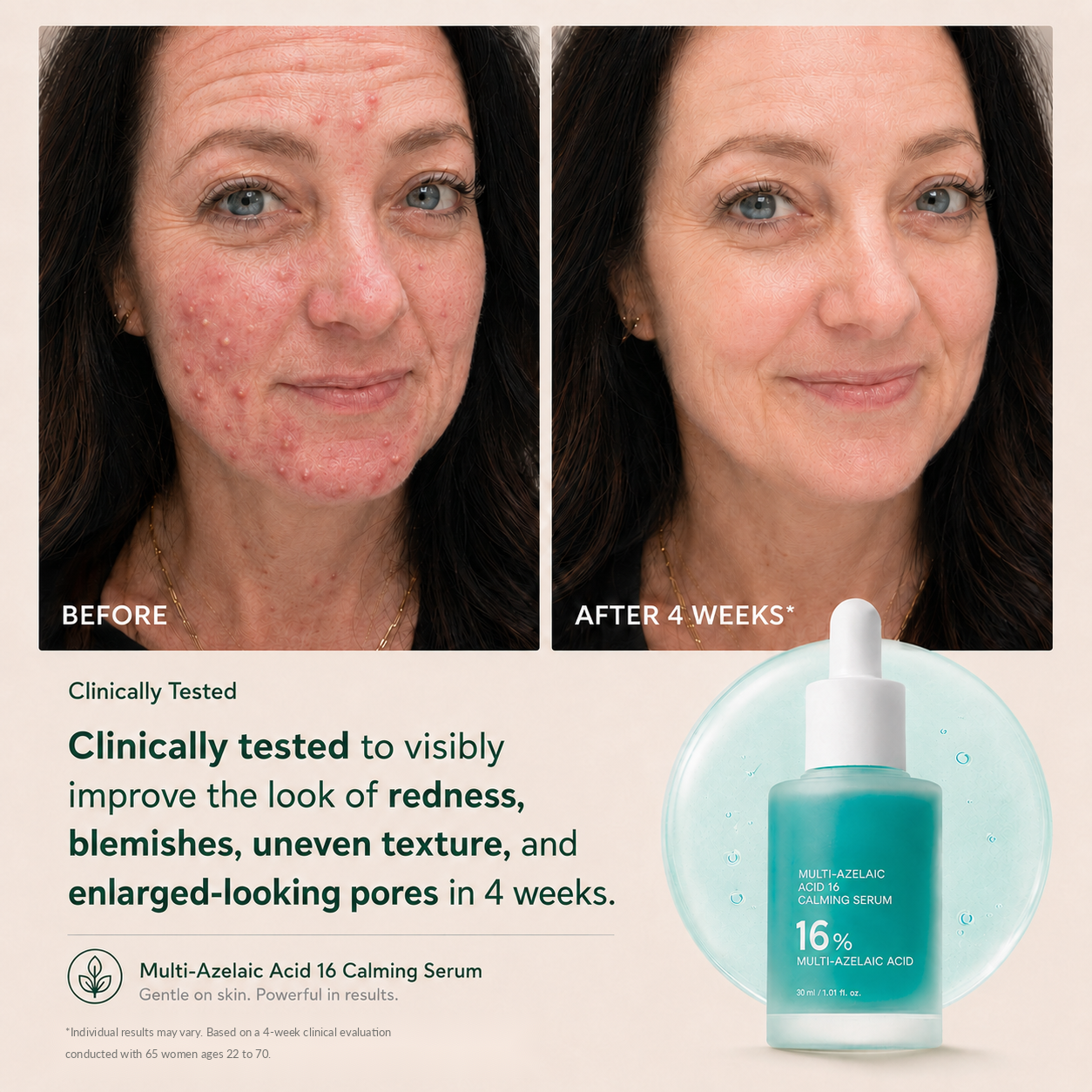Tombrace Anchoic Acid Soothing Serum