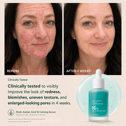 Tombrace Anchoic Acid Soothing Serum